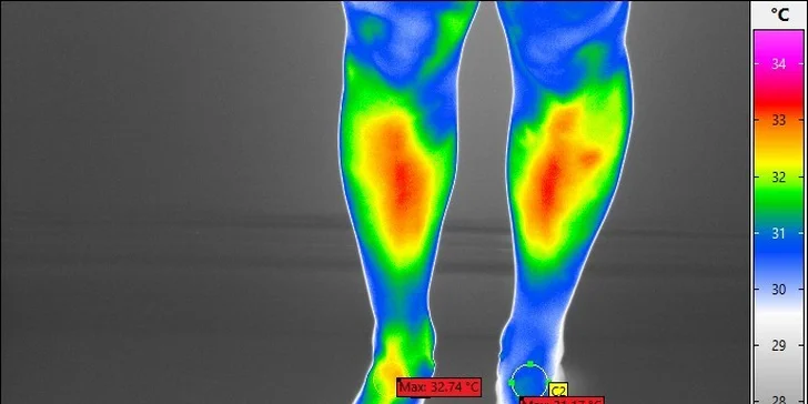 Termoskríning tela medicínskou termokamerou vo Vitare
