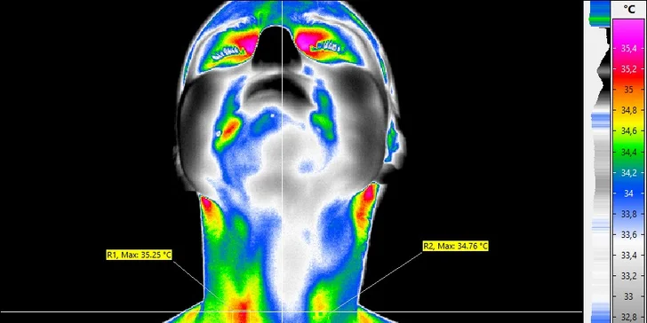 Termoskríning tela medicínskou termokamerou vo Vitare