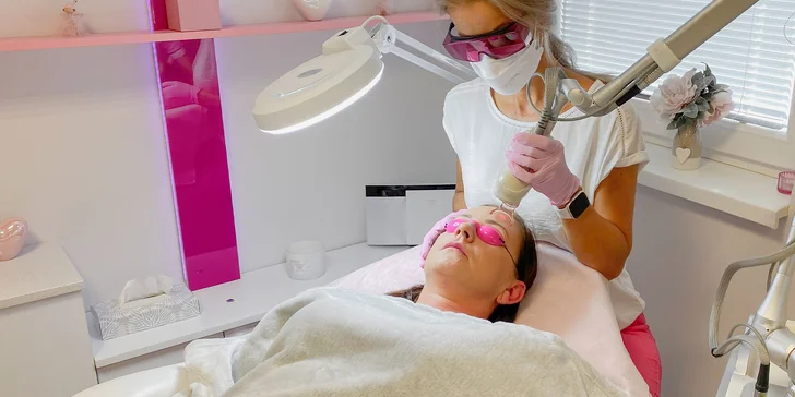 Omladenie frakčným CO2 laserom v Health & beauty clinic Košice