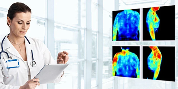 Termoskríning tela medicínskou termokamerou vo Vitare