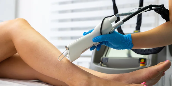 Zbohom, chĺpky! Epilácia medicínskym laserom Light EVO