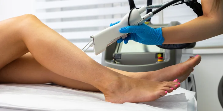 Zbohom, chĺpky! Epilácia medicínskym laserom Light EVO