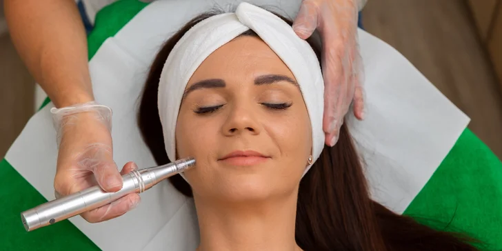 Ošetrenia pleti: Mezoterapia, BioRePeel či chemický peeling