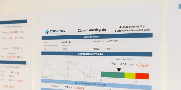 Diagnostika ciev prístrojom ARTERIOGRAPH aj s terapiou