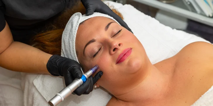 Mezoterapia tváre, tela alebo vlasov pomocou dermapenu