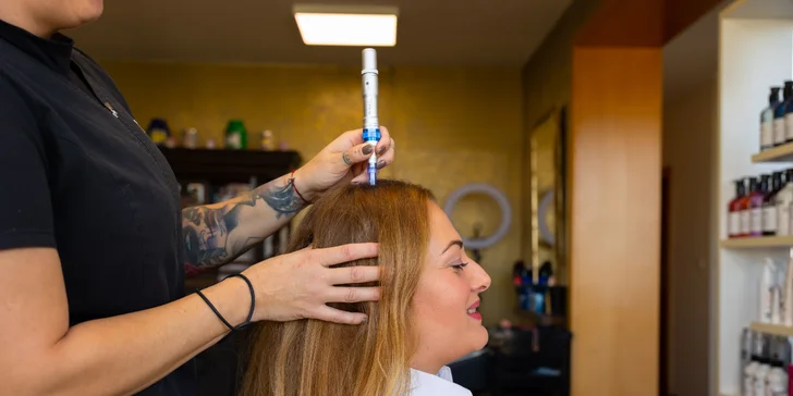 Mezoterapia tváre, tela alebo vlasov pomocou dermapenu