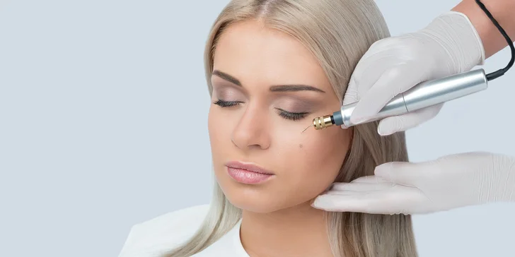 Plasma Pen: zbavte sa vrások pomocou plazmového pera