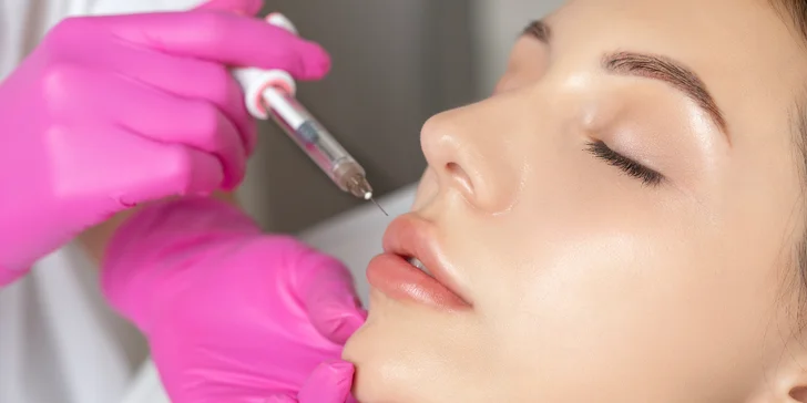 Rehydratácia pier a biorevitalizácia tváre kolagénom a kyselinou hyalurónovou