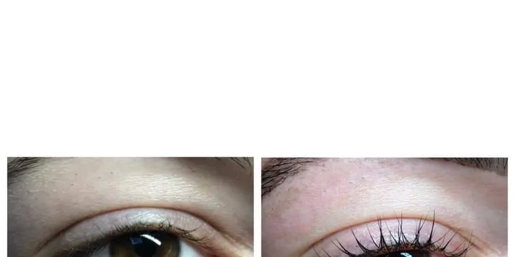 Pleťové ošetrenie na mieru, 4D mihalnice, laminácia obočia aj lash lift