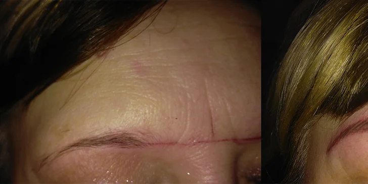 Permanentný make-up: obočie, horné očné linky alebo pery