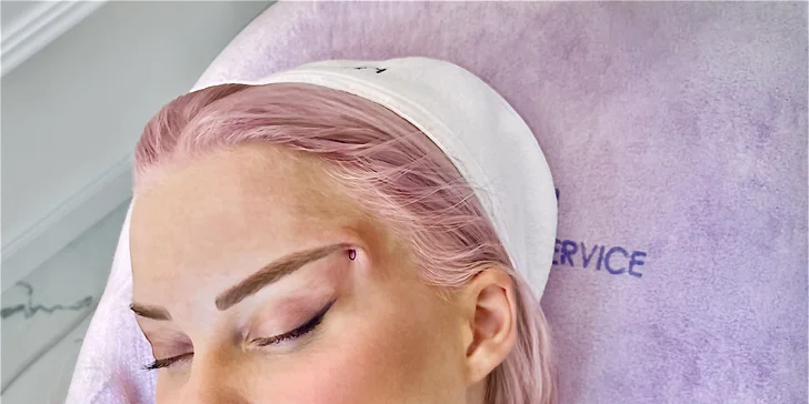 Líščie oči "fox eyes" či niťový lifting tváre pre omladenie