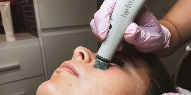 Ošetrenie prístrojom Hydrafacial alebo mezoterapia Dermapenom