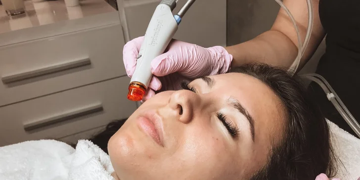 Ošetrenie prístrojom Hydrafacial alebo mezoterapia Dermapenom