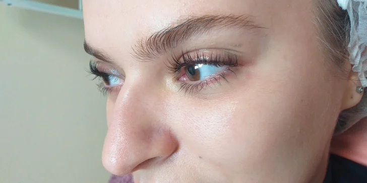 Diamantová mikrodermabrázia, Lash Lifting a iné ošetrenia