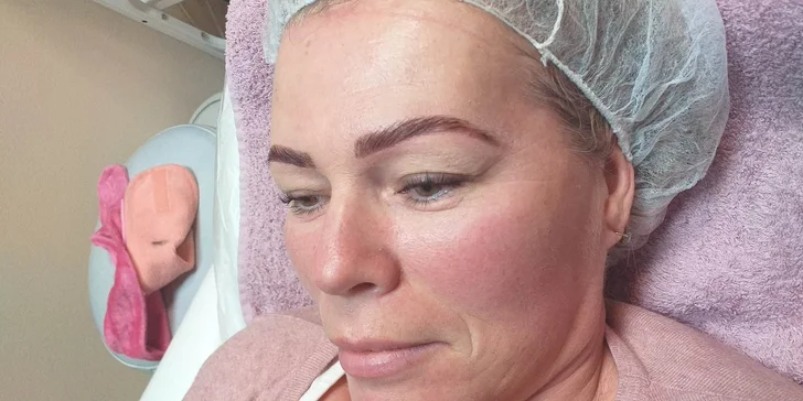 Diamantová mikrodermabrázia, Lash Lifting a iné ošetrenia