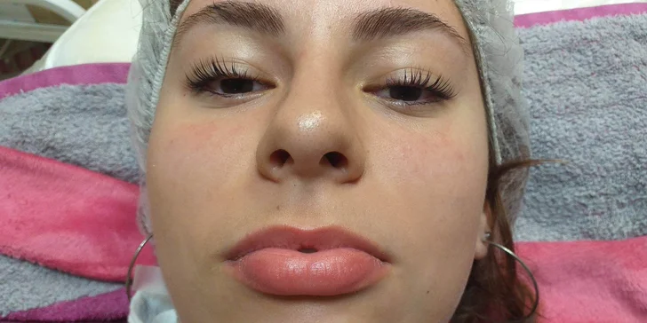 Diamantová mikrodermabrázia, Lash Lifting a iné ošetrenia