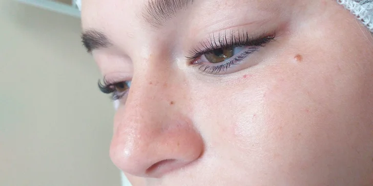 Diamantová mikrodermabrázia, Lash Lifting a iné ošetrenia