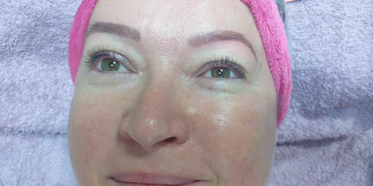 Diamantová mikrodermabrázia, Lash Lifting a iné ošetrenia