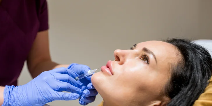 Výplň pier kyselinou hyalurónovou v Bellisima Estetik Center
