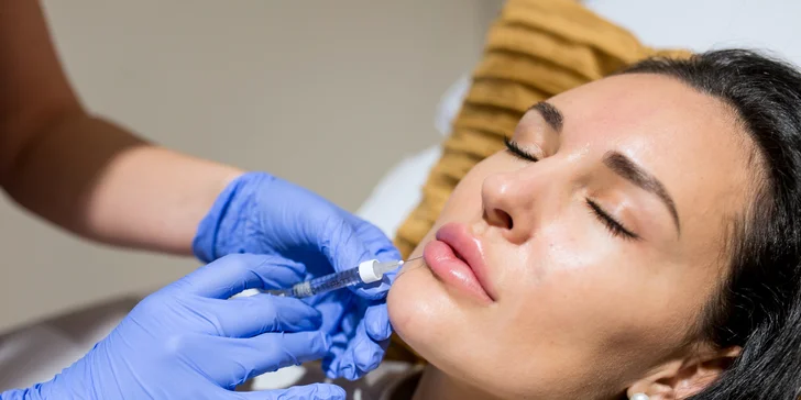 Výplň pier kyselinou hyalurónovou v Bellisima Estetik Center