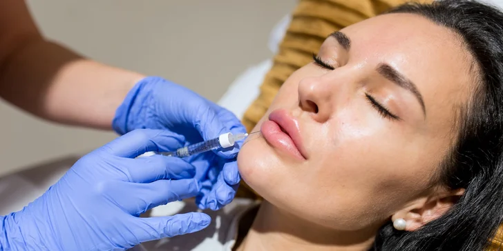 Výplň pier kyselinou hyalurónovou v Bellisima Estetik Center