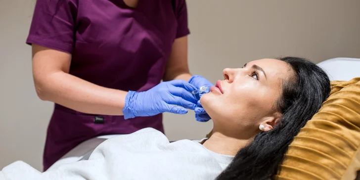 Výplň pier kyselinou hyalurónovou v Bellisima Estetik Center