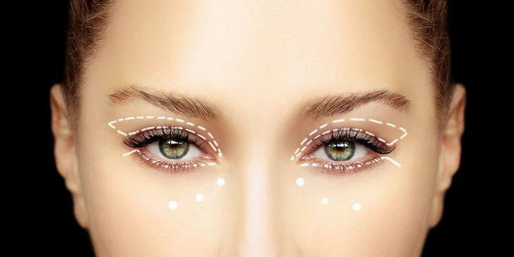 Blefaroplastika: Korekcia horných viečok v Magnifica Clinic