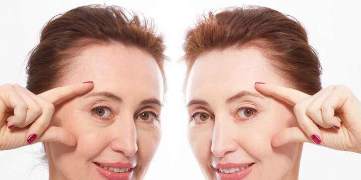 Mini facelift: Omladenie tváre s dlhodobým efektom na klinike Magnifica