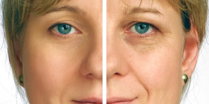 Omladzujúci ANTIAGING coctail pre vašu pleť