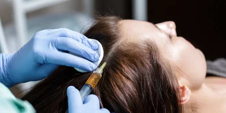 Injekčná mezoterapia vlasov alebo Vital Injector v DermaFresh