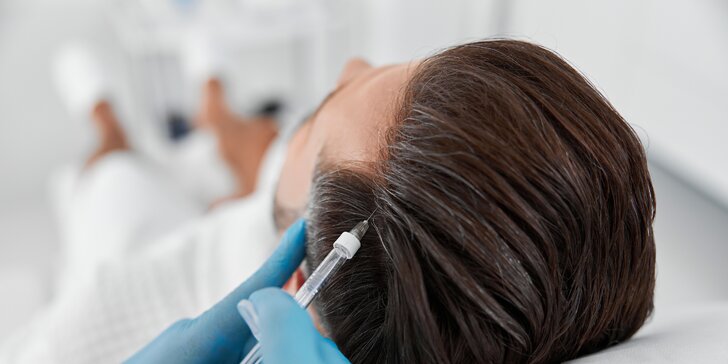 Injekčná mezoterapia vlasov alebo Vital Injector v DermaFresh