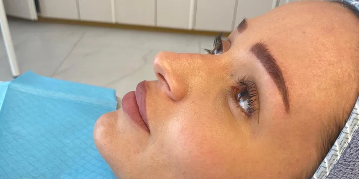 Dajte svojmu pohľadu nový rozmer aplikáciou liftingových nití do okolia očí vo Fabulous beauty