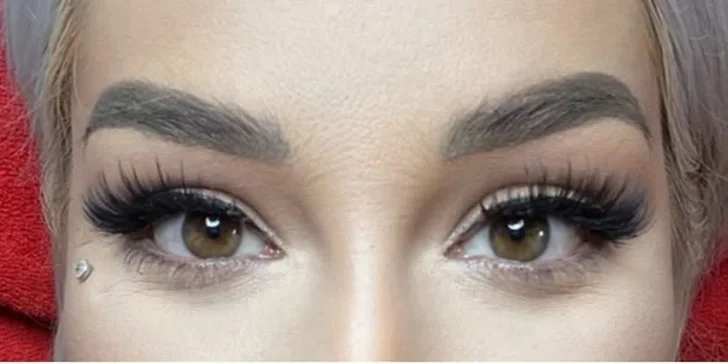 Dajte svojmu pohľadu nový rozmer aplikáciou liftingových nití do okolia očí vo Fabulous beauty