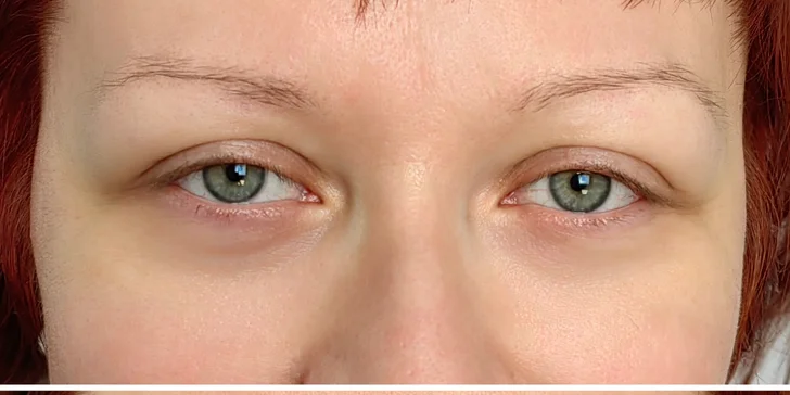 Microblading obočia s korekciou v GLAMORA Beauty Salon