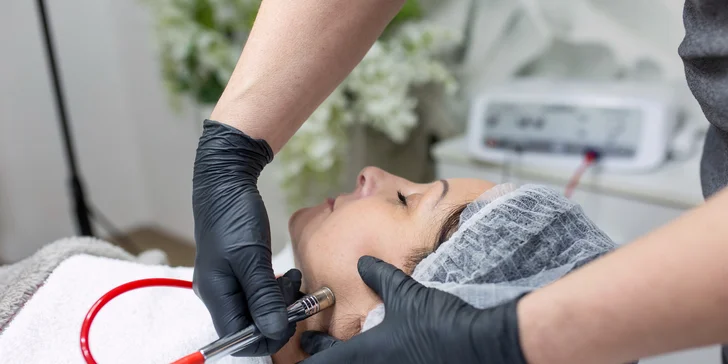 Všetko pre čistú a krásnu pleť: Dermabrázia či rádiofrekvencia