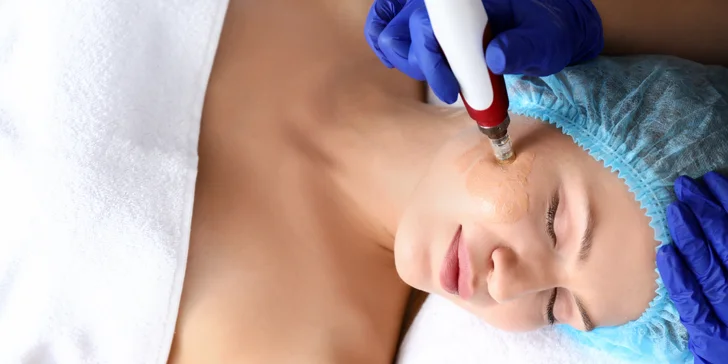 Permanentný make-up BB Glow alebo Microneedling pre krásnu pleť