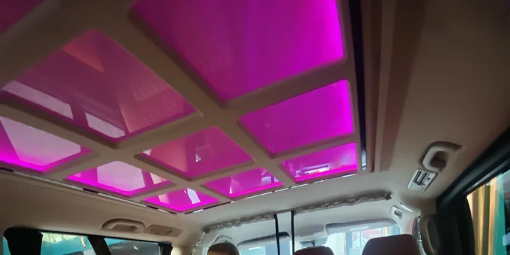 Transplantácia vlasov na špičkovej klinike v Istanbule
