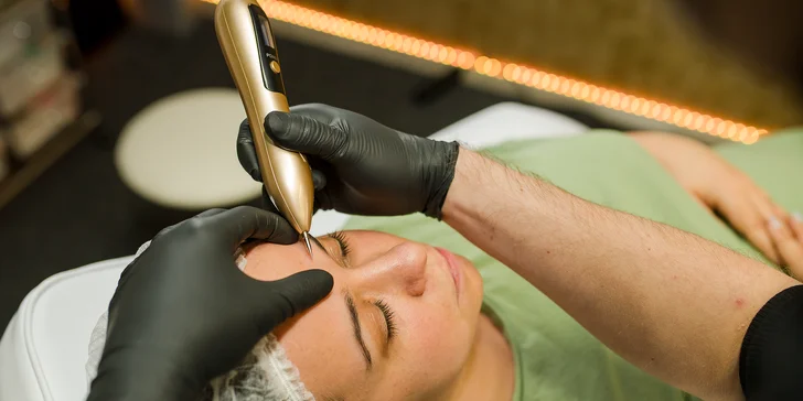 Vyhladenie vrások, nadvihnutie viečok a Mikroihličková mezoterapia pre krásnu pleť