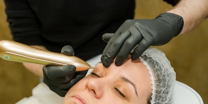 Vyhladenie vrások, nadvihnutie viečok a Mikroihličková mezoterapia pre krásnu pleť