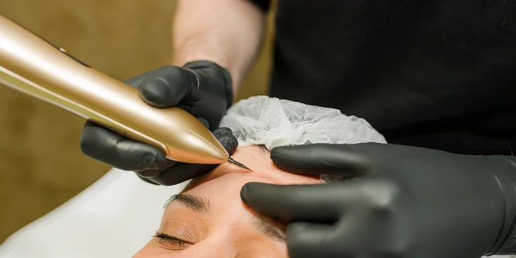 Vyhladenie vrások, nadvihnutie viečok a Mikroihličková mezoterapia pre krásnu pleť