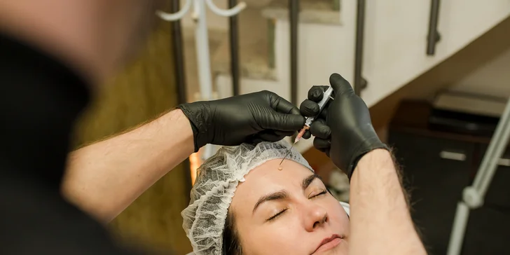 Permanentný make-up BB Glow alebo Microneedling pre krásnu pleť