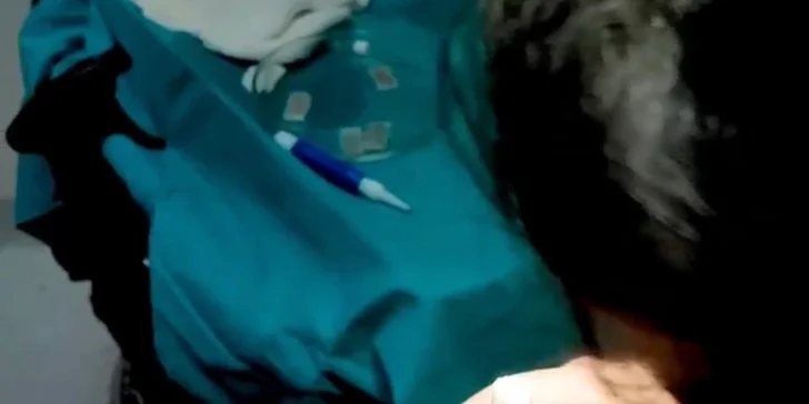 Transplantácia vlasov na špičkovej klinike v Istanbule