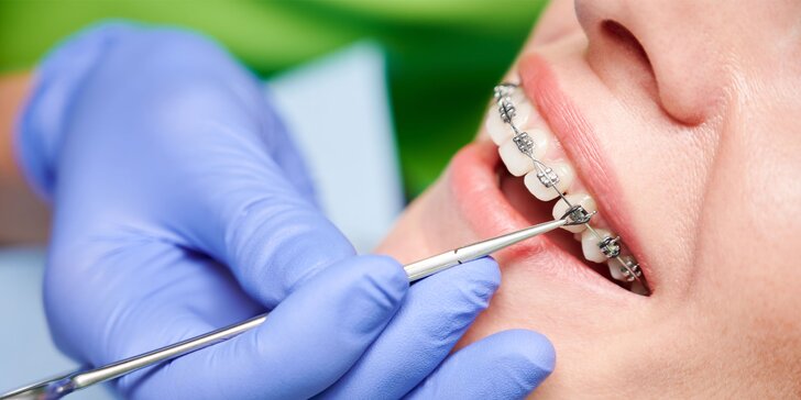 Zubné ošetrenia v Luxury Dent: Bielenie, plomby aj strojček