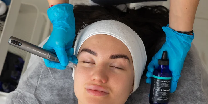 Pleťové ošetrenia v Be beauty: PRO Restore, nanoneedling alebo mikroneedling pomocou pera