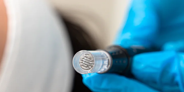 Pleťové ošetrenia v Be beauty: PRO Restore, nanoneedling alebo mikroneedling pomocou pera