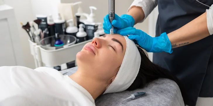 Pleťové ošetrenia v Be beauty: PRO Restore, nanoneedling alebo mikroneedling pomocou pera