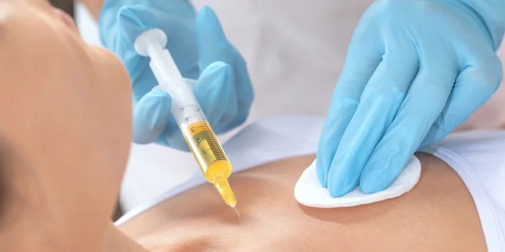 Draculoterapia: Intenzívne omladenie pleti vlastnou plazmou