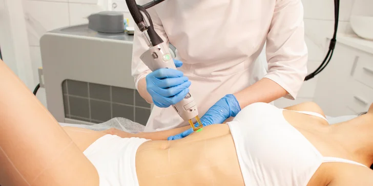 Adieu, chĺpky! Epilácia medicínskym laserom domino EVO