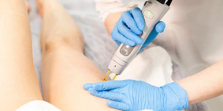 Adieu, chĺpky! Epilácia medicínskym laserom domino EVO
