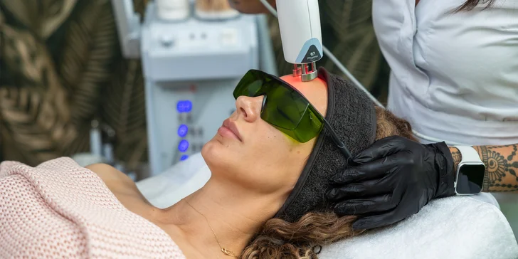 BeautyPark: Omladnite na počkanie a bez bolesti - nechajte si vyplniť vrásky laserom!